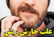 علل ایجاد خارش ریش در آقایان و راههای درمان این معضل